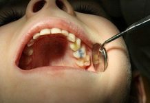 Причины развития пульпита молочных зубов у детей и лечение эффективными и безболезненными способами