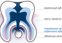 Когда выпадают молочные зубы у детей: схема выпадения