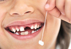 порядок выпадения молочных зубов у детей