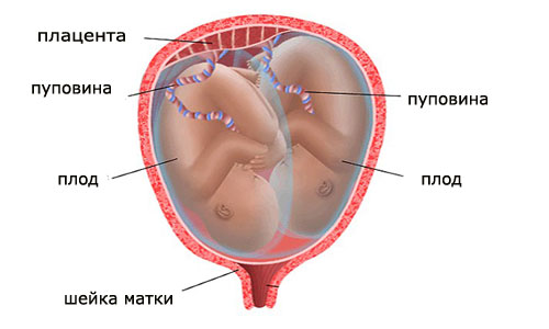 Многоплодная беременность: на ранних сроках.jpg
