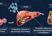 Повышенный билирубин у новорожденных: причины