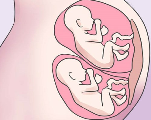 Многоплодная беременность: признаки на ранних сроках.jpg