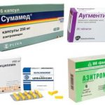 effektivnye-lekarstva-ot-gorla-v-vide-antibiotikov