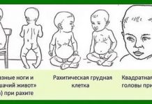 Витамин Д3 для новорожденных