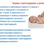 streptodermija-u-detej-foto-kak-nachinaetsja-e1519136145504