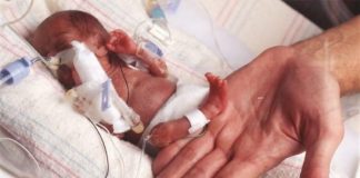 Недоношенный ребенок: последствия в будущем