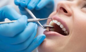 Лечение зубов — особенности и современные подходы